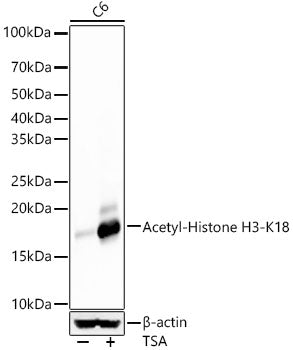 Acetyl-Histone H3-K18 Rabbit mAb