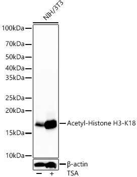 Acetyl-Histone H3-K18 Rabbit mAb