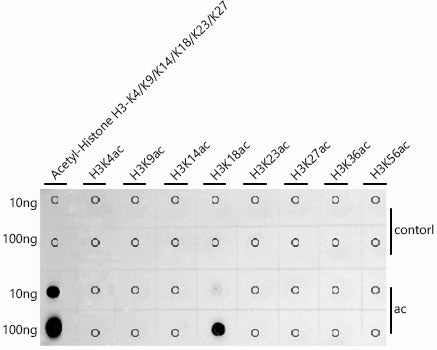 Acetyl-Histone H3-K18 Rabbit mAb