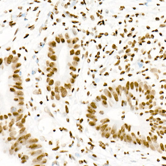 Acetyl-Histone H3-K18 Rabbit mAb