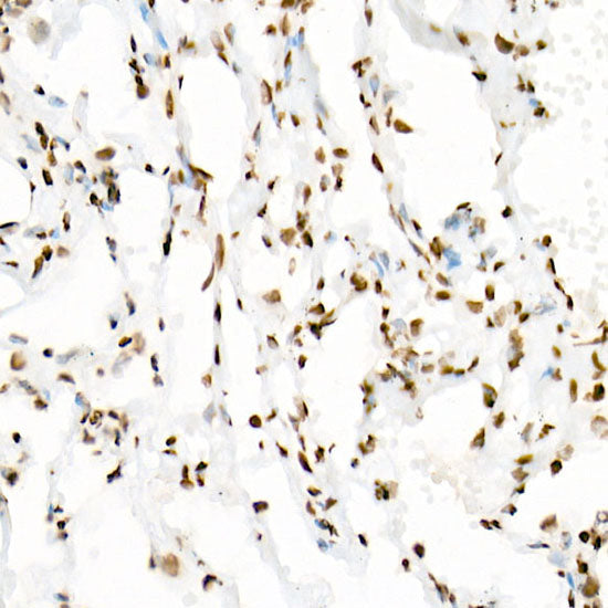 Acetyl-Histone H3-K18 Rabbit mAb
