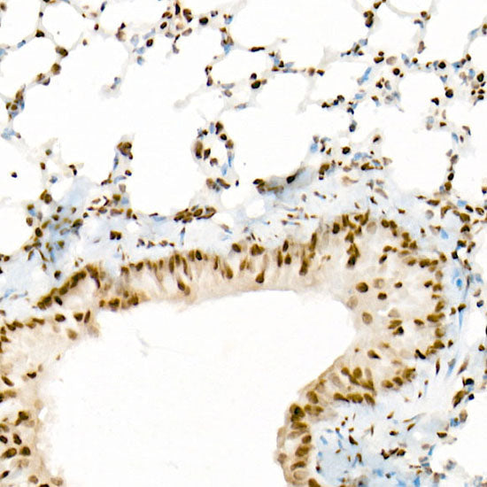 Acetyl-Histone H3-K18 Rabbit mAb