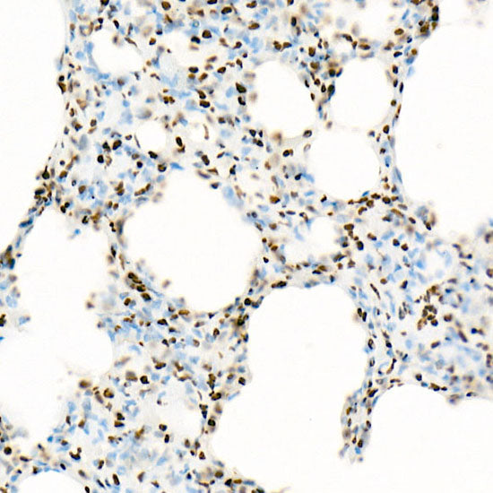 Acetyl-Histone H3-K18 Rabbit mAb