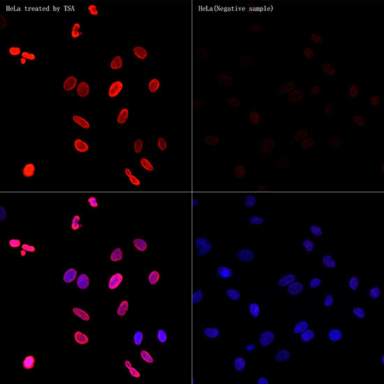 Acetyl-Histone H3-K18 Rabbit mAb