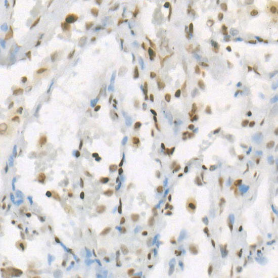 MonoMethyl-Histone H4-K20 Rabbit mAb