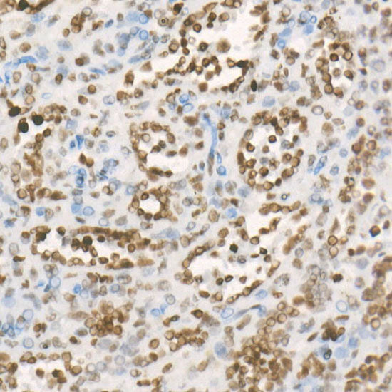 MonoMethyl-Histone H4-K20 Rabbit mAb