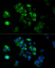 ABflo® 488 Rabbit anti-Human TROP-2 mAb