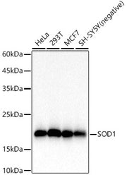 SOD1 Rabbit mAb