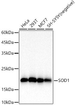 SOD1 Rabbit mAb