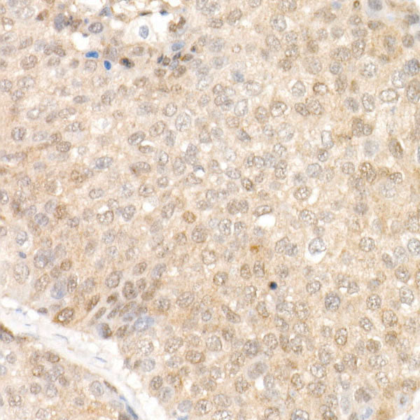 SOD1 Rabbit mAb