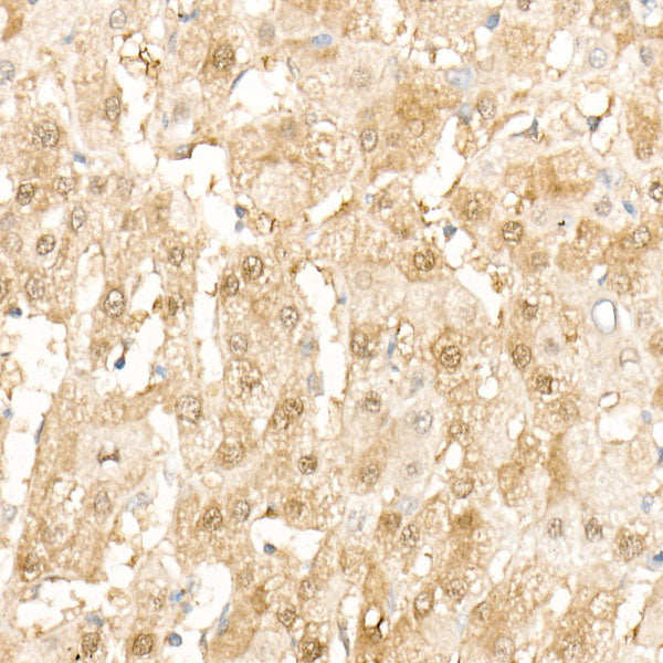 SOD1 Rabbit mAb