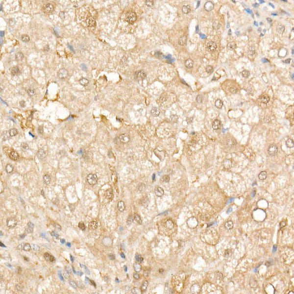 SOD1 Rabbit mAb