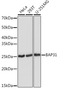 BAP31 Rabbit mAb