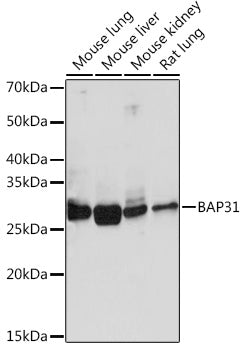 BAP31 Rabbit mAb