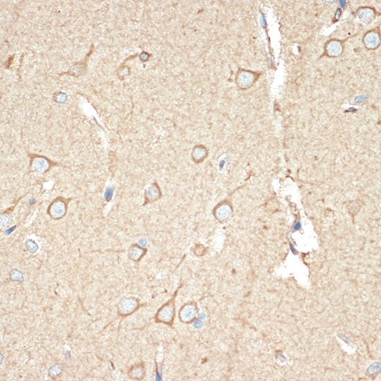 BAP31 Rabbit mAb