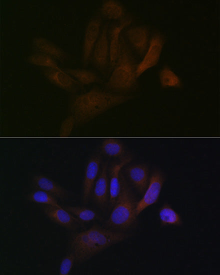 BAP31 Rabbit mAb