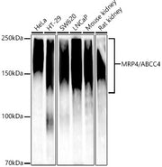 [KD Validated] MRP4/ABCC4 Rabbit mAb