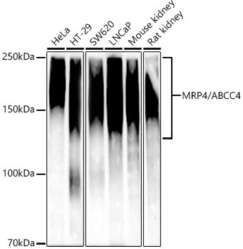 [KD Validated] MRP4/ABCC4 Rabbit mAb