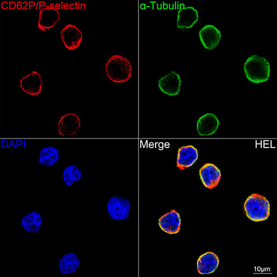 CD62P/P-selectin Rabbit mAb