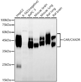 CAR/CXADR Rabbit mAb