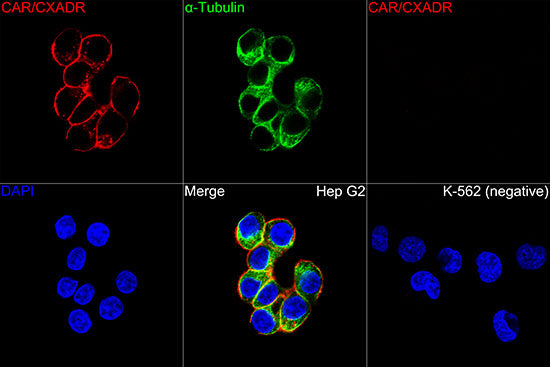 CAR/CXADR Rabbit mAb