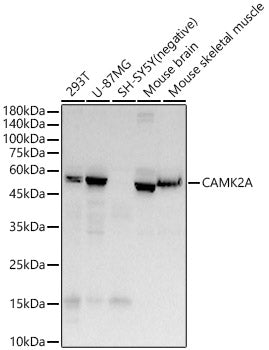 CAMK2A Rabbit mAb