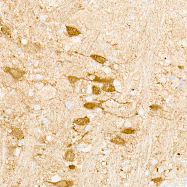 CAMK2A Rabbit mAb