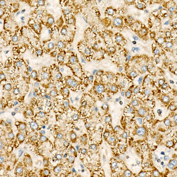 CYP24A1 Rabbit mAb