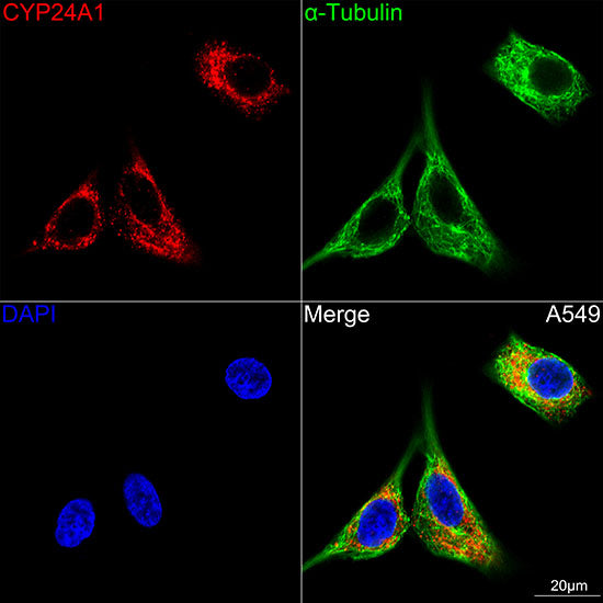 CYP24A1 Rabbit mAb
