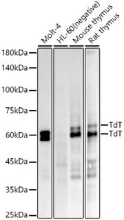TdT Rabbit mAb