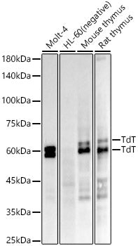 TdT Rabbit mAb