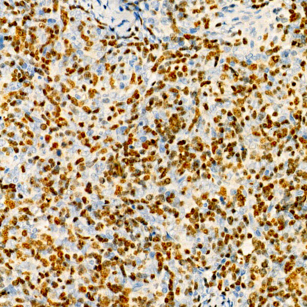 TdT Rabbit mAb
