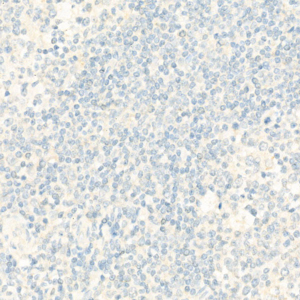 TdT Rabbit mAb