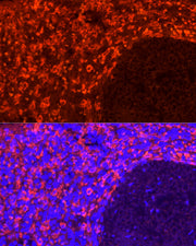 CD163 Rabbit mAb