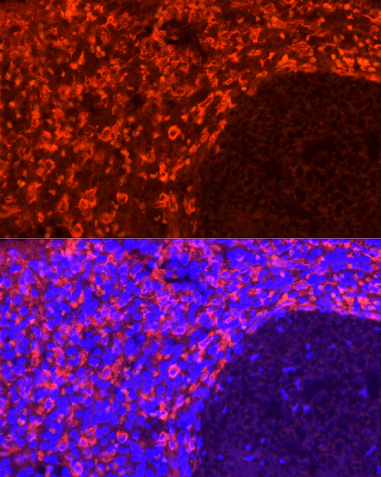 CD163 Rabbit mAb
