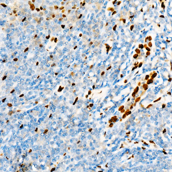IL33 Rabbit mAb