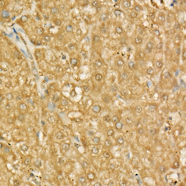 MIF Rabbit mAb