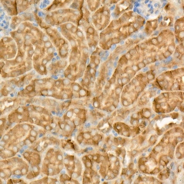 MIF Rabbit mAb