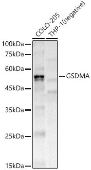 GSDMA Rabbit mAb