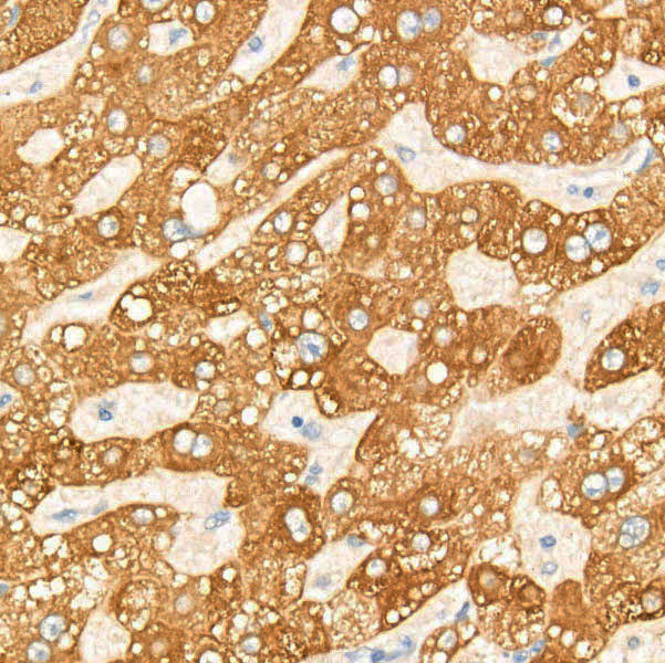 Cytochrome P450 2E1 (CYP2E1) Rabbit mAb