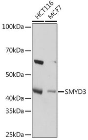 SMYD3 Rabbit mAb