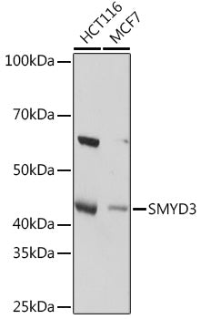 SMYD3 Rabbit mAb