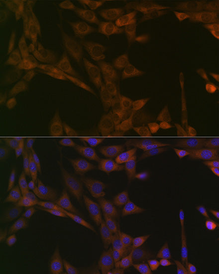 SMYD3 Rabbit mAb