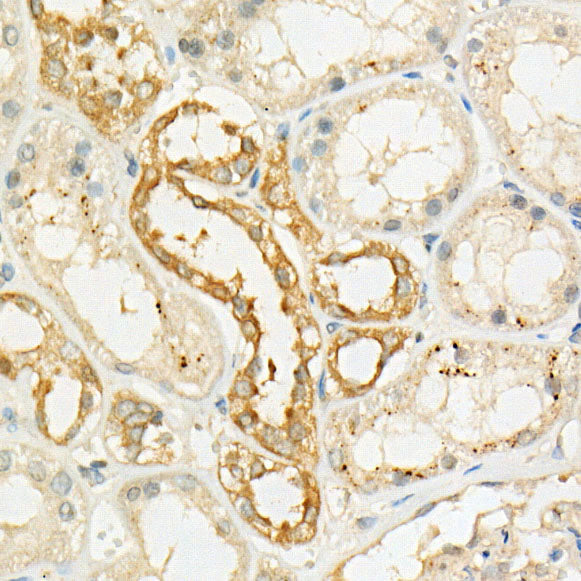 [KO Validated] LKB1 Rabbit mAb