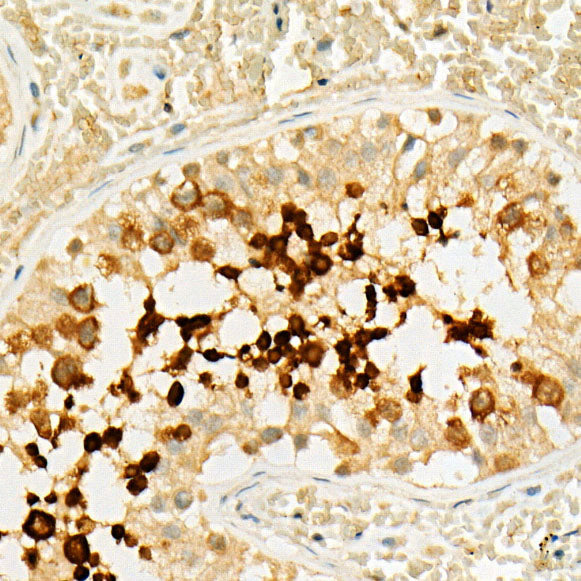 [KO Validated] LKB1 Rabbit mAb