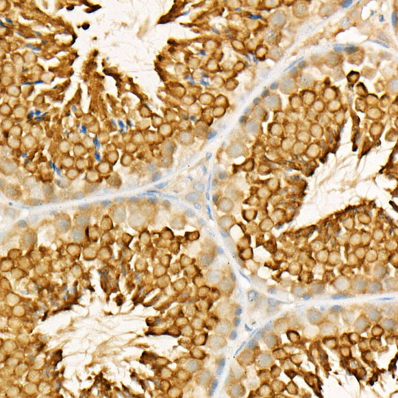[KO Validated] LKB1 Rabbit mAb