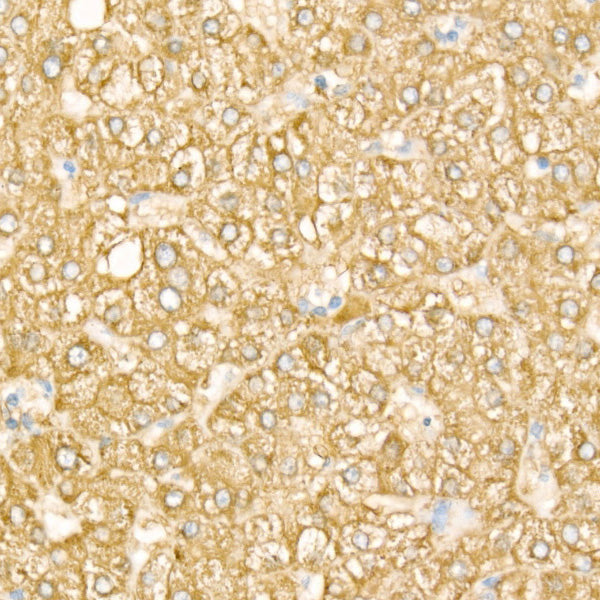 FTCD Rabbit mAb