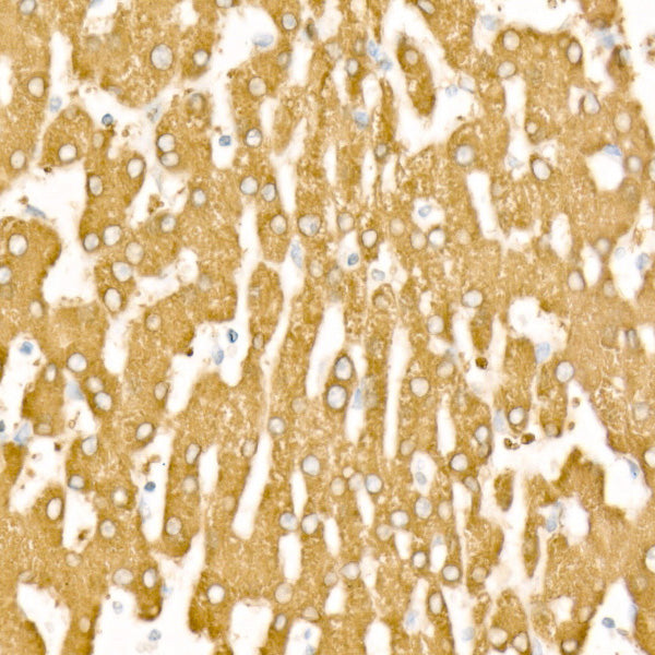 FTCD Rabbit mAb