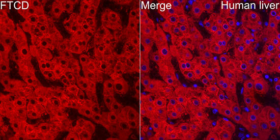 FTCD Rabbit mAb