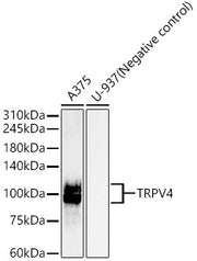 TRPV4 Rabbit mAb
